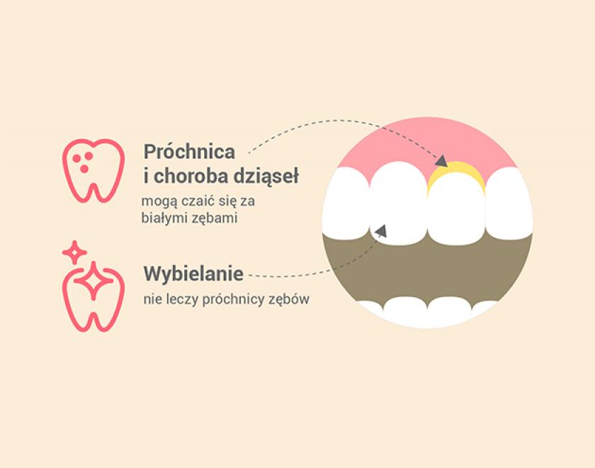 Dentystyczne mity